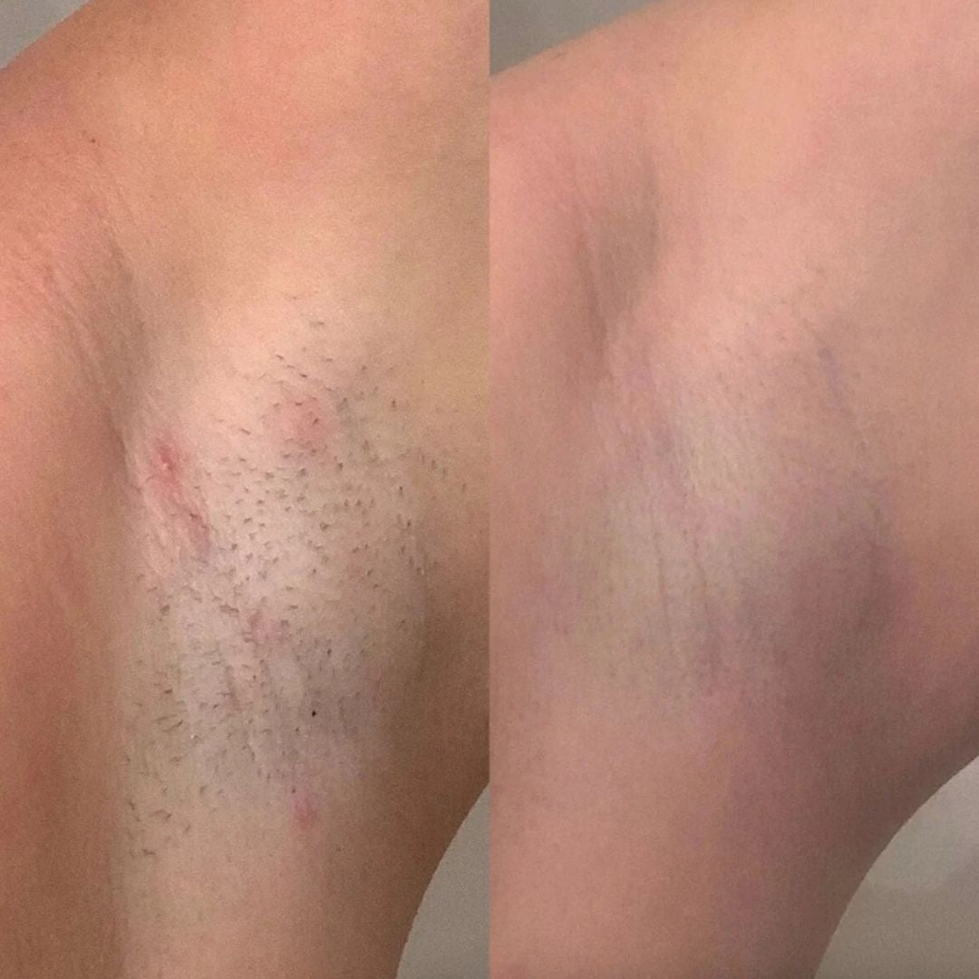 skinfleek classic метална самобръсначка