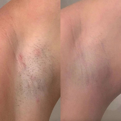 skinfleek classic метална самобръсначка